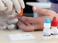 24/11/2015 - Anvisa libera registro de teste rápido de HIV para venda em farmácias  