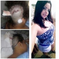 09/04/2016 - Mulher agredida com marreta é operada e está fora de risco de morte 