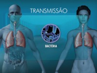 10/04/2016 - Quase 300 índios de aldeias Xavante em município de MT têm tuberculose 